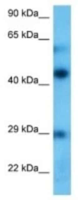 Neuronal Pentraxin 1 Rabbit anti-Human, Polyclonal, Novus Biologicals:Antibodies:Primary